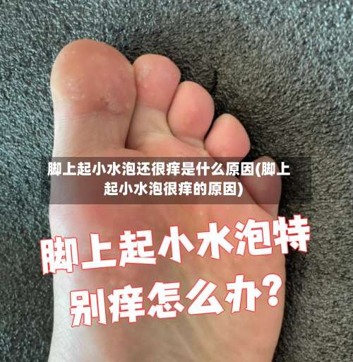 脚上起小水泡还很痒是什么原因(脚上起小水泡很痒的原因)-第1张图片