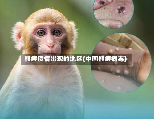 猴痘疫情出现的地区(中国猴痘病毒)-第1张图片